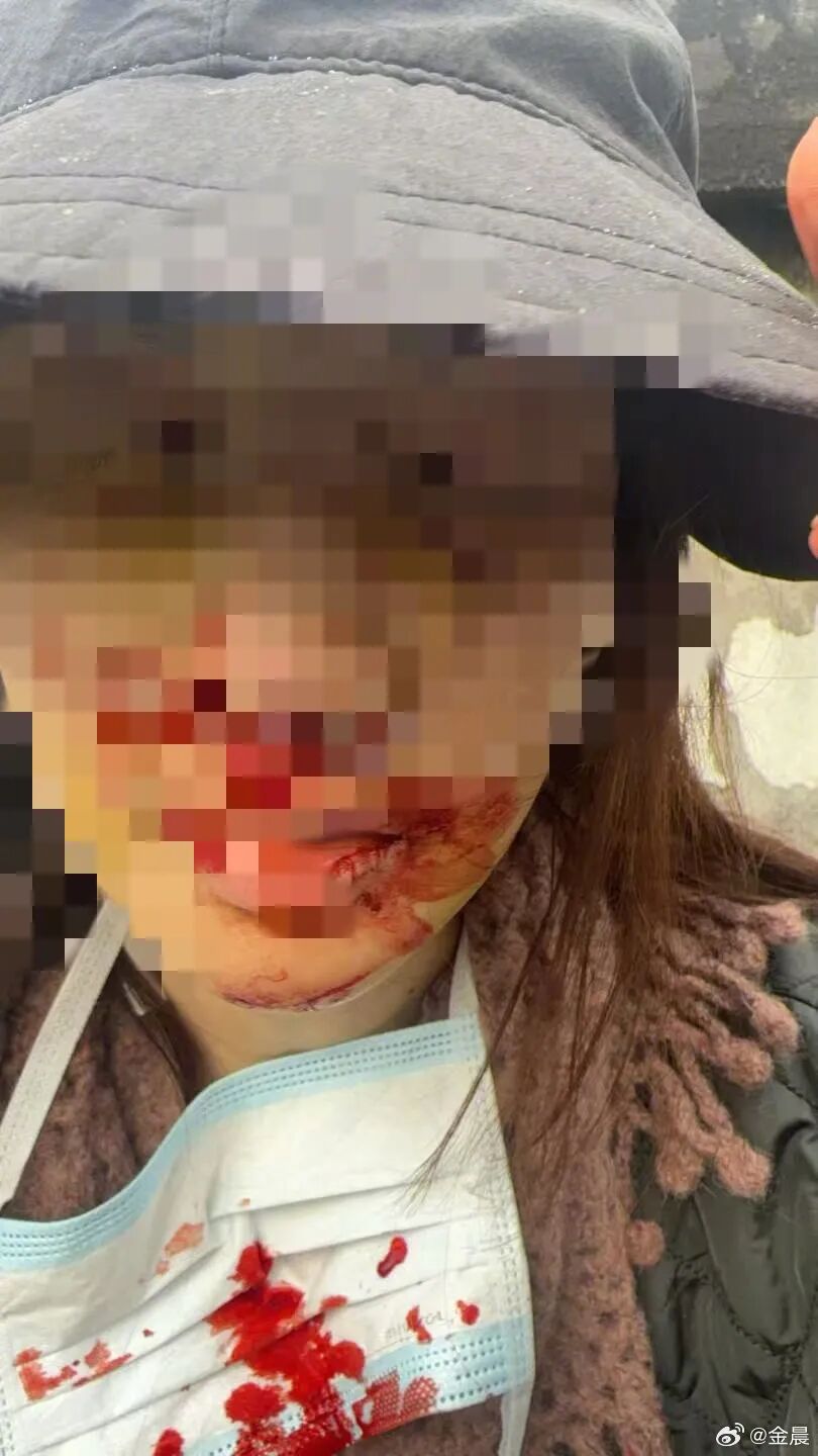 金晨驾车发生事故后自行离去就医，警方最新通报后，她和助理还需要担责吗？律师解读